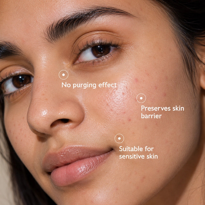 Vinr 2% Salicylic Acid & 5% Niacinamide Serum | Fights Acne & Blackheads | Unclogs Pores | Oil Control | 30 ml