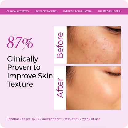 87% clinically proven improvement in skin texture – VINR Glycolic Acid Toner before and after results after 1 month of use
