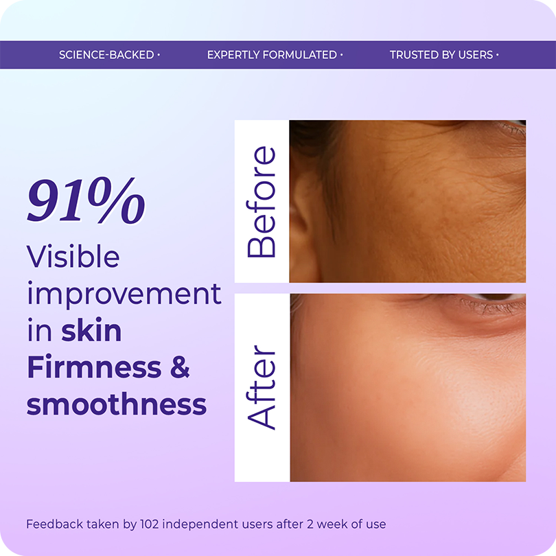 Vinr Retinol Face Moisturiser | Fights Signs of Ageing | Refines Texture | Night Repair Cream | 50 gm