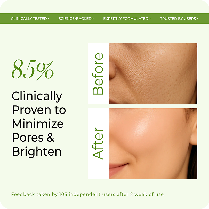 85% clinically proven reduction in pores and skin brightening – VINR Rice Water Niacinamide Toner before and after results
