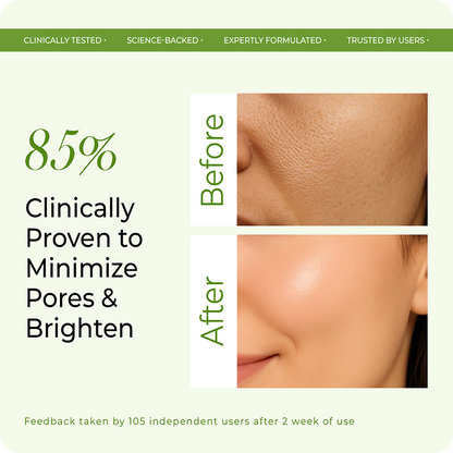 85% clinically proven reduction in pores and skin brightening – VINR Rice Water Niacinamide Toner before and after results
