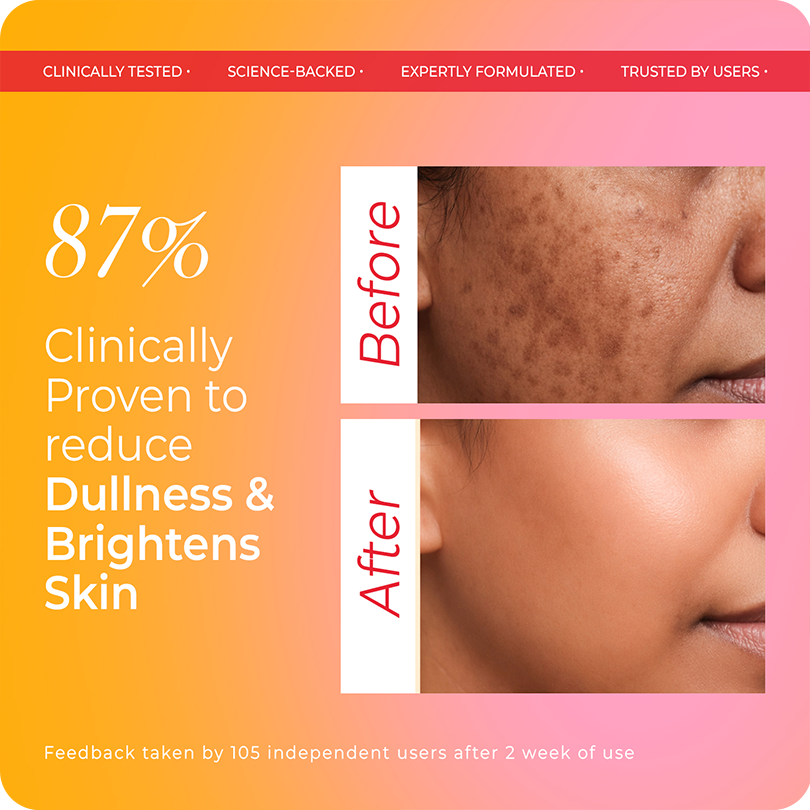 Vinr Vitamin C Facewash | Brightens & Refreshes Skin | Fights Pollution & Tanning | Gentle Gel Cleanser | 100 ml