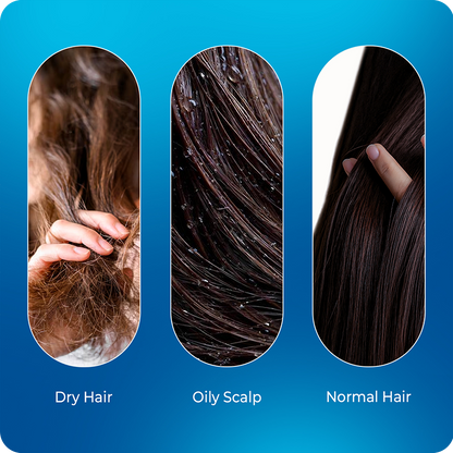 VINR Hair Serum suitable for men and women—a lightweight, non-sticky daily scalp serum