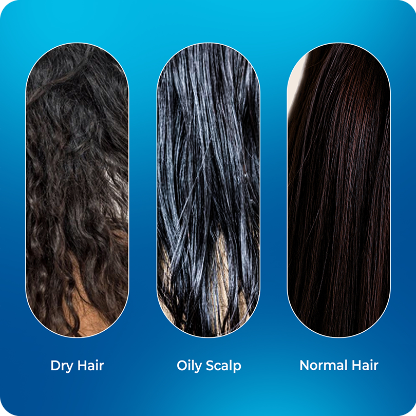 Vinr Rosemary Water Hair Spray with Grape Seed Extract | Reduces Hair Fall | Boosts Growth & Scalp Health | 100 ml