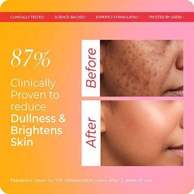 87% clinically proven reduction in dullness and skin brightening—VINR Vitamin C Face Wash before and after 