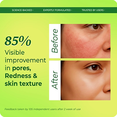 VINR Niacinamide Face Booster before and after—85% visible improvement in pores, redness, and texture